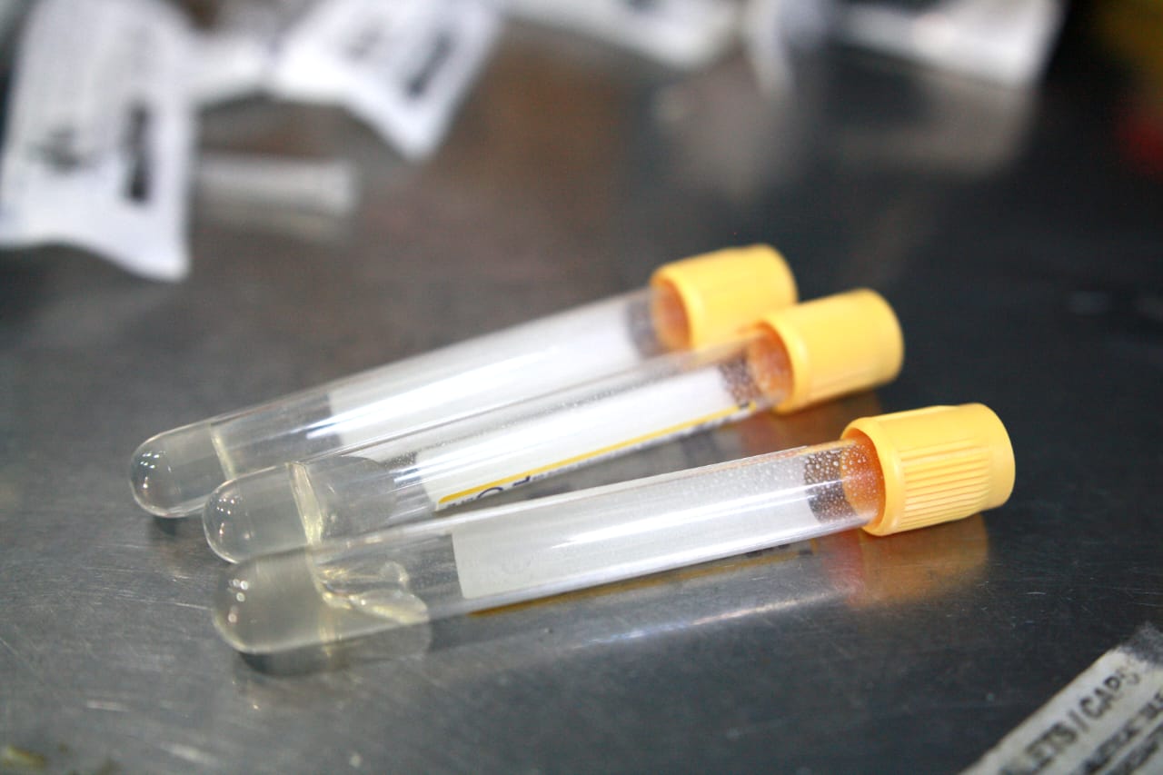 Sample collection tubes at the practice
